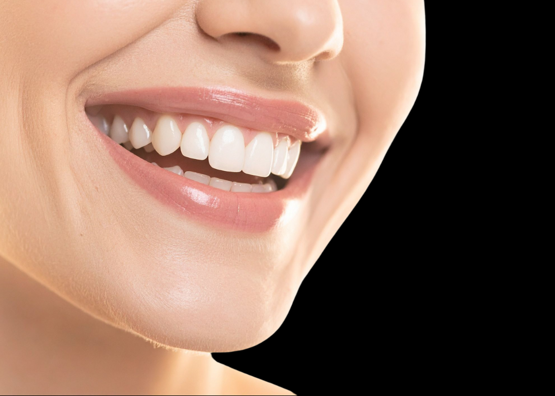 Smile Design